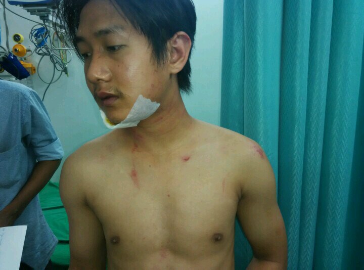 Attack on North east people